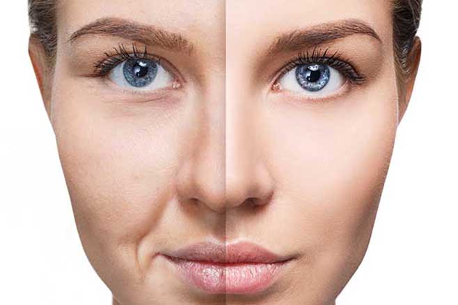 skin ageing treatment