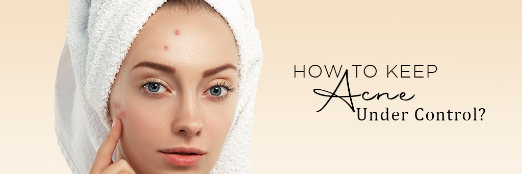 How To Keep Acne Under Control ?