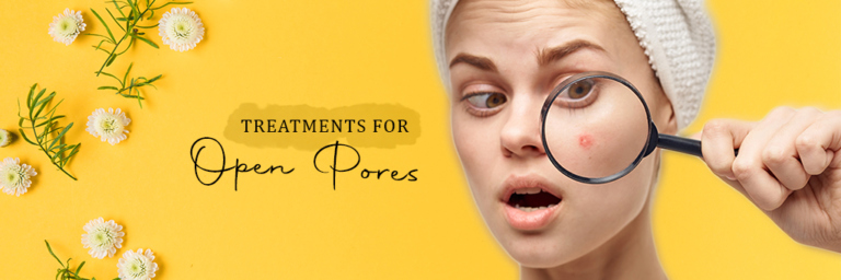 Treatments for Open Pores