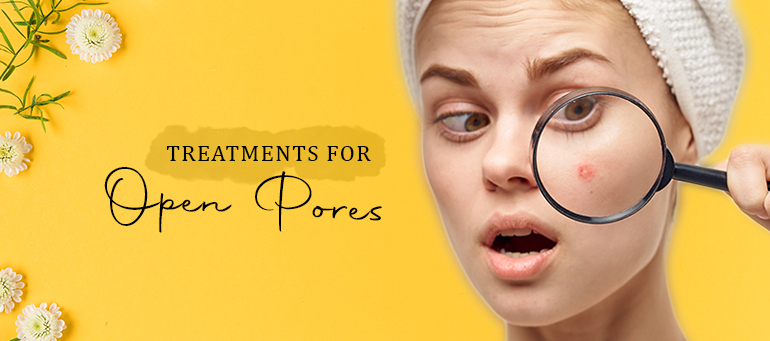 Treatments for Open Pores